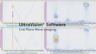 UltraVision® for Live Plane Wave Imaging [upl. by Simmons]