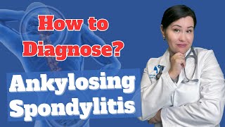 How to Diagnose Ankylosing spondylitis  Dr Diana Girnita [upl. by Alyn]