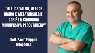 Alluce valgo alluce rigido e metatarsalgie Cos’è la Chirurgia Mininvasiva Percutanea [upl. by Tnahs626]