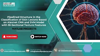 Pipelined Structure in the Classification of Skin Lesions Based on Alexnet CNN and SVM Model with Bi [upl. by Liauqram]