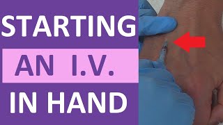 How to Start an IV  IV Catheter Insertion amp Flush Technique in Hand  Nursing Skill [upl. by Mahala]