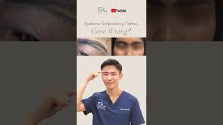 Eyebrow Embroidery Tattoo GONE WRONG shorts doctor aesthetic eyebrows tattooremoval [upl. by Natlus171]