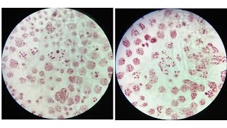 LeptoteneZygotenePachyteneDiplotene amp Diakinesis stages of meiosis with identifying characters [upl. by Ttenaej]