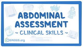 Abdominal Assessment Clinical Skills [upl. by Alurta945]