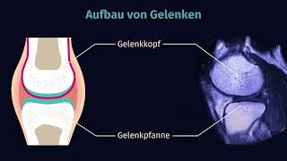 Gelenke – Bau und Typen einfach erklärt  sofatutor [upl. by Alda]