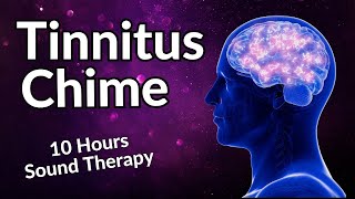 Tinnitus Chime  Sound Therapy For Relax amp Relief [upl. by Kessia]