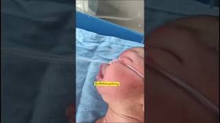 Opisthotonos posture in newborn  care of newborn baby  newborn born baby  youtubeshorts [upl. by Hobart100]