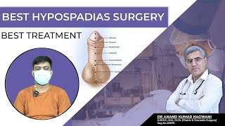 Best Hypospadias Surgeon in Kolkata  मूत्र का छिद्र सही जगह पर न खुलने की समस्या  Dr Nagwani [upl. by Nahtnahoj284]