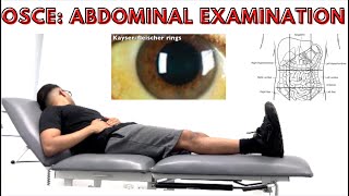 OSCE Abdominal Examination [upl. by Bubb]