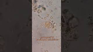 entamoeba histolytica locomotion pseudopodia amazing [upl. by Ahker862]