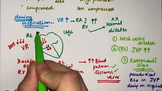 Cardiac tamponade  pathophysiology  clinical features  MEDICINE with DR SHAMAMA [upl. by Judas5]