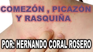 COMEZON  PICAZON Y RASQUIÑA URTICARIA Y PRURITO GENERAL [upl. by Seltzer]