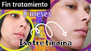 Tratamiento con ISOFACE 8 meses Storytime [upl. by Gretal]