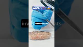 Worms Around You trending shorts factshealth [upl. by Aihsiym]