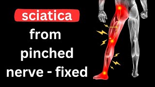 ⚡️Sciatica  Long Term Relief From A Pinched Nerve [upl. by Elleira196]