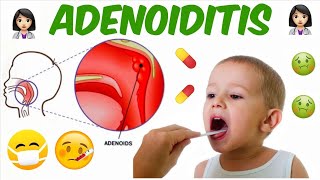 PharyngoTonsillitis and Adenoiditis  Part 2  ENT [upl. by Kra345]