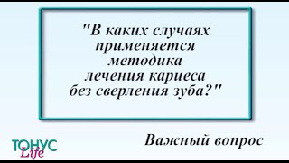 В каких случаях применяется методика лечения кариеса без сверления зуба [upl. by Nelleh]