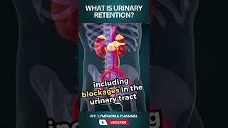 What is urinary retention shorts [upl. by Malory135]