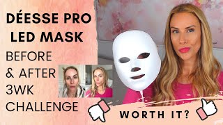 Déese Pro LED Mask  3wks Before amp After  Honest Review [upl. by Coffeng]