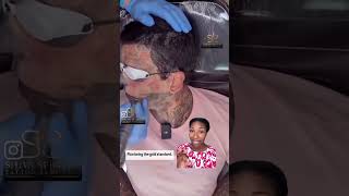 Full face tattoo removal [upl. by Linis]