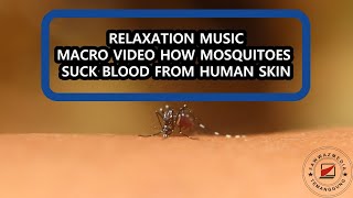 RELAXATION MUSICMACRO VIDEO HOW MOSQUITOES SUCK BLOOD FROM HUMAN SKIN [upl. by Anahcra319]