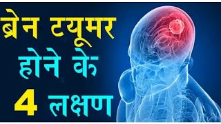 Brain Tumor hone ke Lakshan aur Pehchan। kya aapko bhi hai brain tumor Kaise Pata kare । [upl. by Indira]