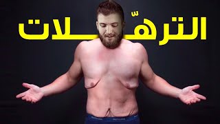 كيف تخلصت من الجلد الزائد بعد نزول وزني 60 كيلو [upl. by Sabas699]