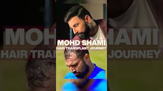 quotMOHAMMED SHAMIS HAIR TRANSFORMATION  Incredible Hair Transplant Journeyquot mohammedshami hair [upl. by Suirradal]