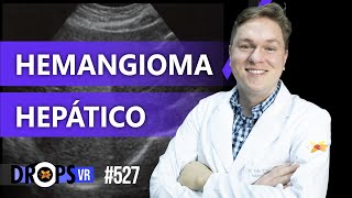 COMO RECONHECER HEMANGIOMA HEPÁTICO NA ULTRASSONOGRAFIA  VOCÊ RADIOLOGISTA [upl. by Zamora]