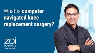 What is computer navigated knee replacement surgery  Zoi Hospitals [upl. by Ackley]