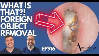 WHAT IS THAT FOREIGN OBJECT REMOVAL  EP916 [upl. by Anihsit]