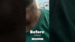 Skin allergy treatment skin  derma skincare  by Dr Danish pasha [upl. by Arahahs]