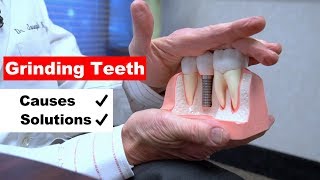 Grinding Teeth Bruxism  A Major Cause of Gum Recession [upl. by Ariamo395]