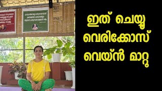 Yoga for varicose vein Malayalam healthtipsmalayalam [upl. by Thaddus399]