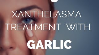 Xanthelasma treatment with garlic does it work [upl. by Joelie]