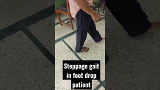 What is Steppage gait in foot drop patient  What is foot drop gait  high steppage gait [upl. by Dillon500]