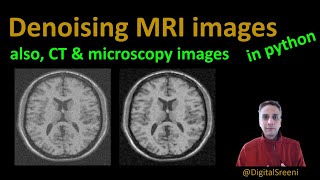 94  Denoising MRI images also CT amp microscopy images [upl. by Ayeka]