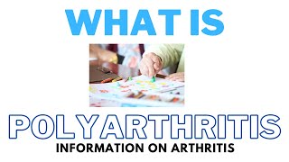 What Is Polyarthritis  The Cause The Symptoms amp The Diagnosis [upl. by Damita]