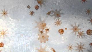 Moon Jellies at the Ephyra stage feeding Brine Shrimp [upl. by Alyal]