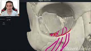 FISURA ORBITARIA INFERIOR [upl. by Imiaj]