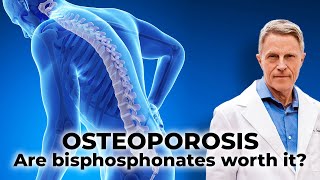 Osteoporosis – Are bisphosphonates worth it [upl. by Caprice]