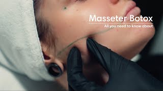 Masseter botox [upl. by Enaud]