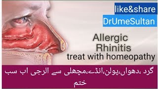 Allergic Rhinitis homeo medicine dust allergic pollen allergy tips and tricks vlogs pakistani [upl. by Elliot]