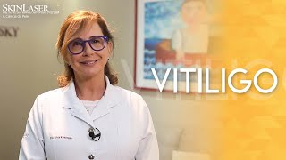 Tratamento para Vitiligo [upl. by Aicad]