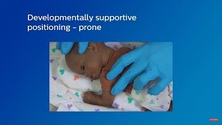 Developmentally supportive infant positioning  prone [upl. by Lertsek]