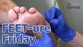 FEETure Friday 2023 [upl. by Codie]