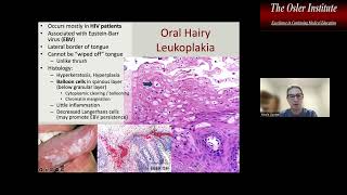 Osler Anatomic Pathology Online Review 2022 Sample [upl. by Ainet110]