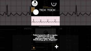 Identify the ECG arrhythmias and comment the answer for the last ECG shown ecg ekg cardiology [upl. by Fransisco]