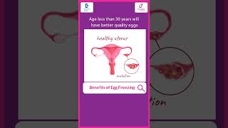 Benefits of EGG FREEZING  When is right age to Freeze Eggs  Dr Meenu Handa  Doctors Circle [upl. by Ihcelek]