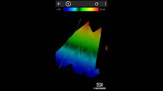 Android Gradiometer Using [upl. by Amolap112]